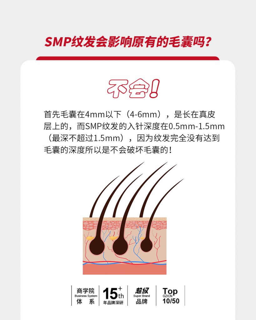 SMP纹发会影响原有的毛囊吗
