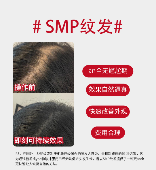 新选择SMP纹发